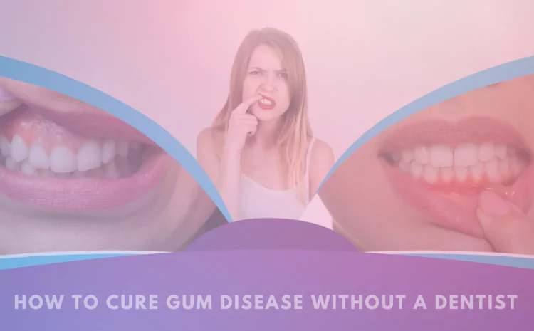 How to Cure Gum Disease Without a Dentist